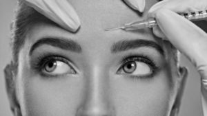 brow lift