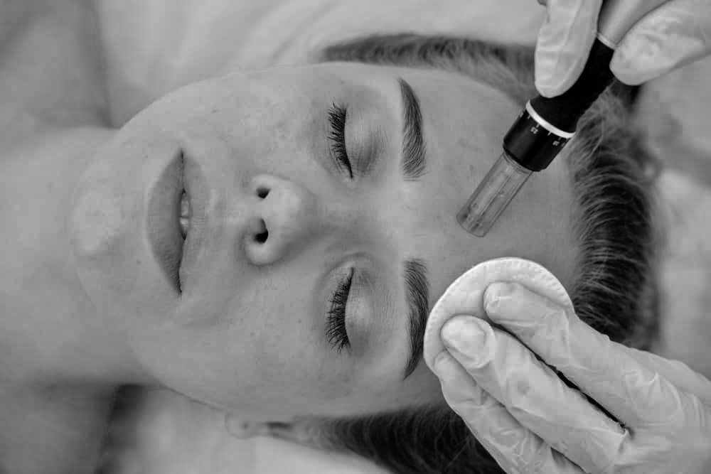 benefits of microneedling for skin rejuventation